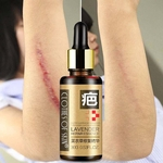 30g Lavender Reparação Pele Essential Oil Cuidados com a pele Tratamento de Acne Blackhead Whitening Essence