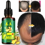 30ml Mulheres Homens Care Cabelo Crescimento essência líquida rápida restauração da perda do cabelo Ferramenta de Nutrição