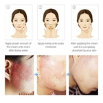 15ml de repara??o da pele Serum Facial Skin Oil Care Natural Powerful Repair Scar