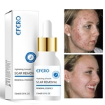 Anti-Rugas Hidratante Acne Belas Pore rejuvenescimento Essence solução de reparação Lifting Facial endurecimento da pele
