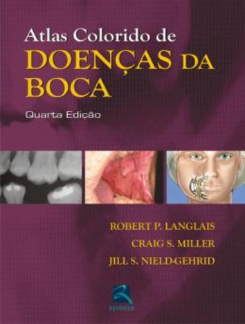 Atlas Colorido de Doencas da Boca - 4ª Ed