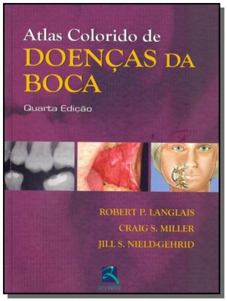 Atlas Colorido de Doencas da Boca - Revinter