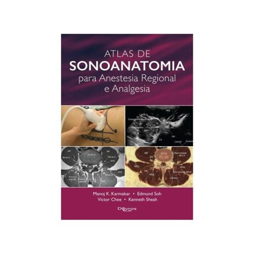 Atlas de Sonoanatomia para Anestesia Regional e Analgesia