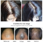 Cabelo Essence Crescimento Spray de Prevenção calvície Consolidar Essência da perda de cabelo Anti saudável Gastronomia Raízes Hair Care