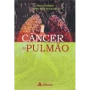 Câncer do Pulmão