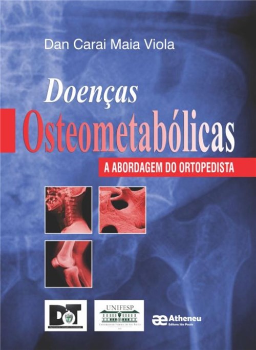 Doencas Osteometabolicas