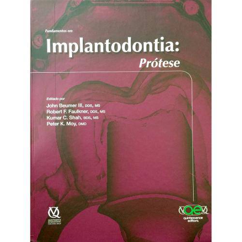 Fundamentos em Implantodontia - Prótese
