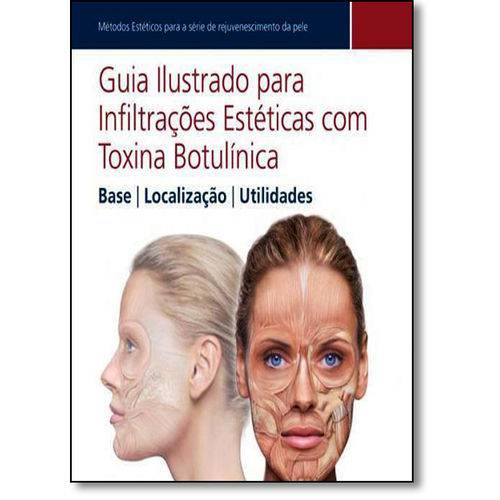Guia Ilustrado para Infiltracoes Esteticas com Toxina Botulinica: Base, Localizacao e Utilidades