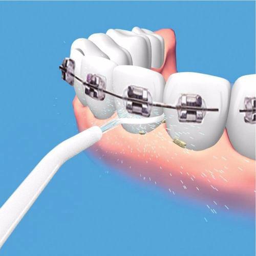 Irrigador Dental Oralfloss Limpeza Profunda Denteaparelho P5 - Ammimport