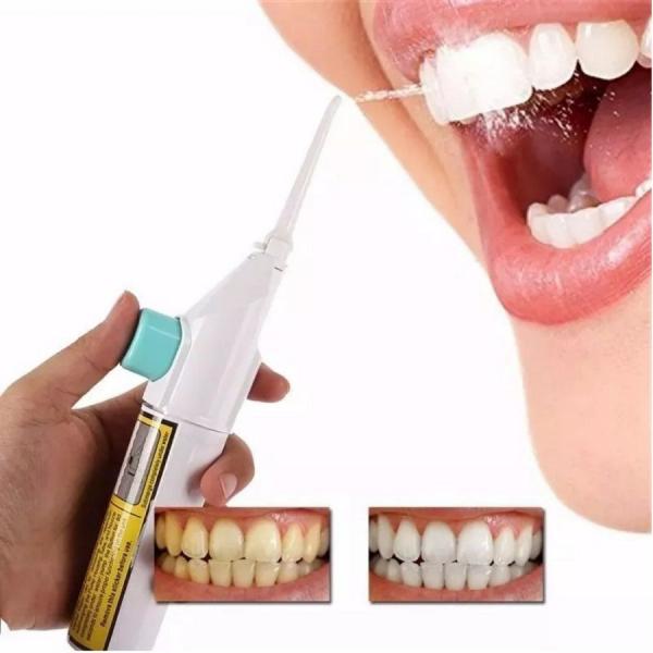 Kit com 4 Jato de Agua Limpeza Oral Dental Bucal - Mc²