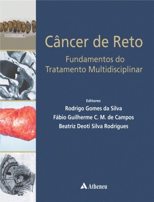 Livro - Câncer de Reto - Fundamentos do Tratamento Multidisciplinar - Silva