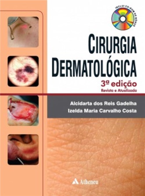 Livro - Cirurgia Dermatológica em Consultório - Gadelha