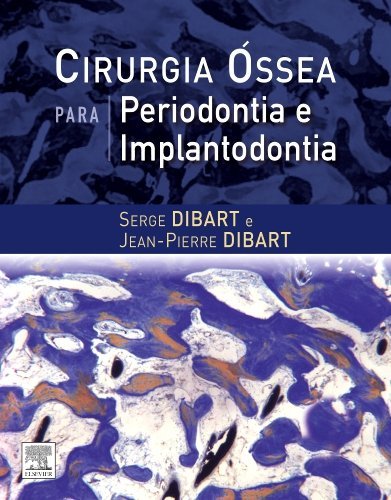Livro - Cirurgia Óssea para Periodontia e Implantodontia