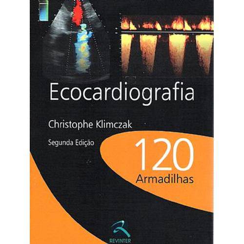 Livro -Ecocardiografia 120 Armadilhas - Klimczak
