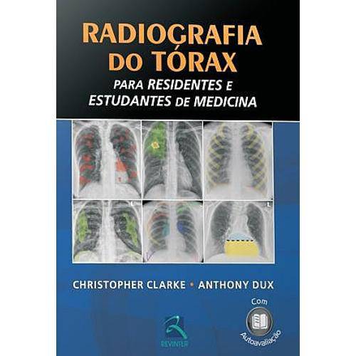 Livro - Radiografia do Tórax para Residentes e Estudantes de Medicina - Clarke