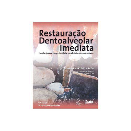 Livro - Restauração Dentoalveolar Imediata - Implantes com Carga Imediata em Alvéolos Comprometidos - Rosa