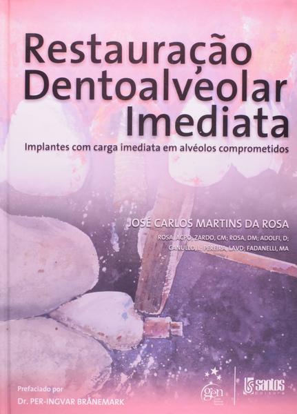 Livro - Restauração Dentoalveolar Imediata - Implantes com Carga Imediata em Alvéolos Comprometidos
