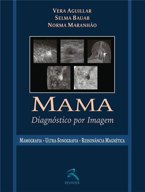 Mama - Diagnostico por Imagem