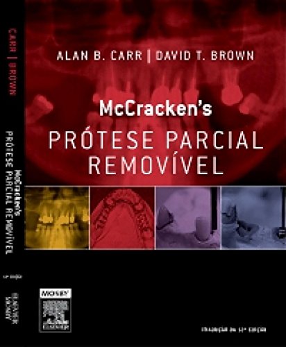 Mccracken Prótese Parcial Removível