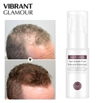 O crescimento do cabelo VIBRANTE GLAMOUR Essence Spray de Prevenção calvície Consolidar a perda de cabelo Anti Nutrir Raízes Hair Care Serum
