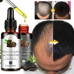 2 Pcs / set Perda Natural Anti-Hair Herbal Professional Líquido Essencial rapidamente Promover Fluid crescimento do cabelo
