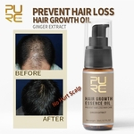 Rápido crescimento do cabelo 20ml Essência Tratamento Líquido Perda Prevenção Hair Care Cabelo Óleo Essencial