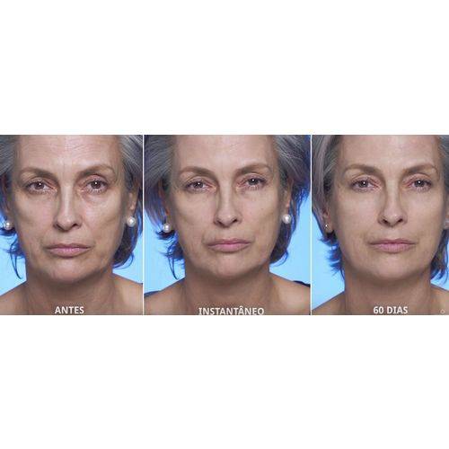 Routine Age Reverse Booster Treatment