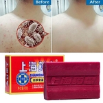 Sabão Xangai Banho Mão Corpo Limpeza Ácaros Remoção Anti-Bacteriano Cuidados Com A Pele Sabão