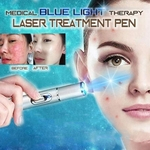 Sardas A Laser Caneta De Remoção De Acne Com Mancha Escura Ferramenta De Beleza Médica Para Terapia Com Luz Azul