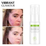 Tea Tree Anti-Acne Serum Acne Scar Acne Tratamento Anti-rugas Oil-controle encolher poros Essence Repairing Facial Mask