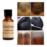 Tratamento Calvície Anti Queda Alopecia Crescimento Cuidado Cabelos 20ml Andrea Hair