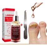 Ficha técnica e caractérísticas do produto 12ml Nail Repair Essence Serum Tratamento Fúngico Remove Toe Nourishing Hand Foot Care