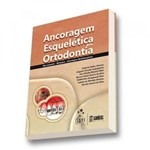 Ficha técnica e caractérísticas do produto Ancoragem Esqueletica em Ortodontia - Santos
