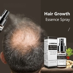 Ficha técnica e caractérísticas do produto Cabelo Essence Crescimento Spray de Prevenção calvície Consolidar Essência da perda de cabelo Anti saudável Gastronomia Raízes Hair Care