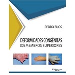 Ficha técnica e caractérísticas do produto Deformidades Congenitas dos Membros Superiores