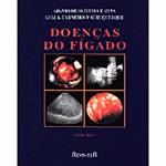 Ficha técnica e caractérísticas do produto Doenças do Fígado  2 Vols