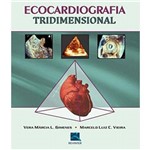 Ecocardiografia Tridimensional