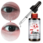 Ficha técnica e caractérísticas do produto Eye Creme Hidratante Remover Black Eye Círculo Fat Remoção Granulado Anti-envelhecimento Cuidados com os olhos