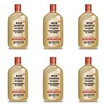 Ficha técnica e caractérísticas do produto Gota Dourada Quimicamente Tratados Shampoo 430ml - Kit com 06