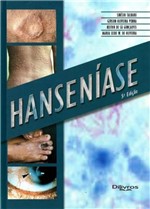 Ficha técnica e caractérísticas do produto Hanseniase - Di Livros