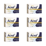 Kit 6x Sabonete Antiacne Acnol Reduz Oleosidade Evita Cravos E Espinhas Na Sua Pele 80g - Uso Diário