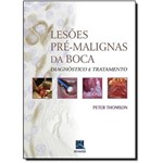 Ficha técnica e caractérísticas do produto Lesões Pre-Malignas da Boca: Diagnostico e Tratamento