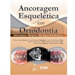 Ficha técnica e caractérísticas do produto Livro - Ancoragem Esquelética em Ortodontia