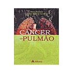 Ficha técnica e caractérísticas do produto Livro - Câncer do Pulmão