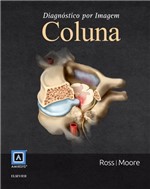 Ficha técnica e caractérísticas do produto Livro - Diagnóstico por Imagem: Coluna - Ross - Elsevier