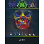 Ficha técnica e caractérísticas do produto Livro - Disjunção Maxilar