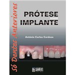 Ficha técnica e caractérísticas do produto Livro - Prótese Sobre Implante: só Dentes Anteriores