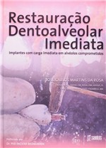 Ficha técnica e caractérísticas do produto Livro - Restauração Dentoalveolar Imediata - Implantes com Carga Imediata em Alvéolos Comprometidos - Rosa - Santos