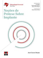 Ficha técnica e caractérísticas do produto Noções de Prótese Sobre Implante (Abeno)