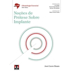 Ficha técnica e caractérísticas do produto Noções de Prótese Sobre Implante